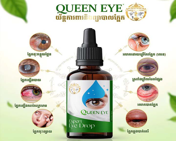 QUEEN EYE - Herbal Eye Drops for Complete Eye Care