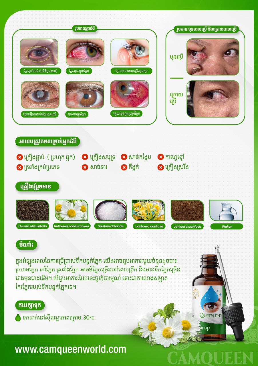 QUEEN EYE - Herbal Eye Drops for Complete Eye Care